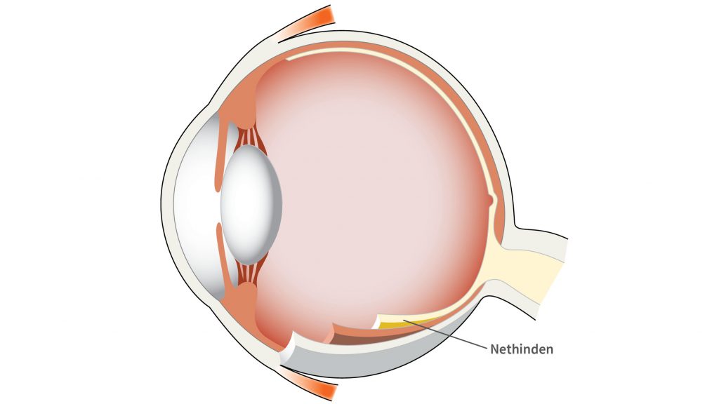 Nethinden sidder fast på indersiden af øjet og er hjem for vores mange millioner synsceller.