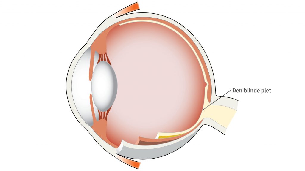 Den blinde plet (papillen) er et område på nethinden, som mangler lysfølsomme synsceller (fotoreceptorer).