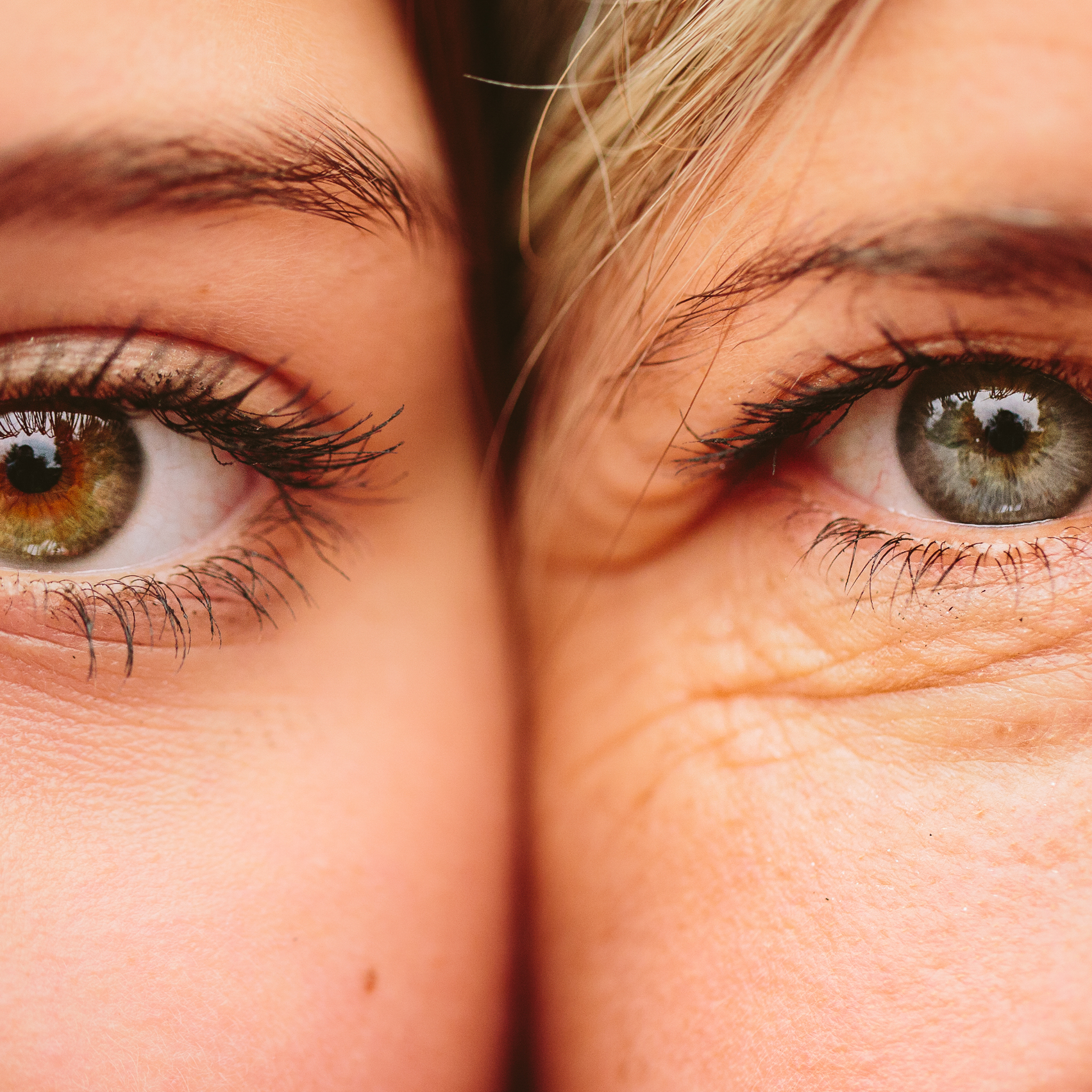 Kan min øjenfarve ændre sig ved en synskorrigerende operation?